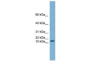 HRK antibody used at 1 ug/ml to detect target protein.