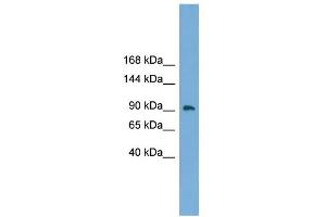 WB Suggested Anti-ZNF226 Antibody Titration:  0. (ZNF226 anticorps  (Middle Region))