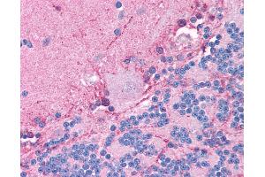 Anti-CLIC6 antibody IHC of human brain, cerebellum.