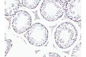 Immunohistochemistry of paraffin-embedded Mouse testis using Bcl9 antibody (ABIN6129972, ABIN6137514, ABIN6137515 and ABIN6222543) at dilution of 1:100 (20x lens). (BCL9 anticorps)