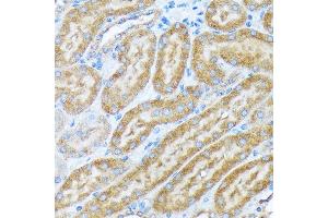 Immunohistochemistry of paraffin-embedded mouse kidney using COPA Rabbit mAb (ABIN7266423) at dilution of 1:100 (40x lens).