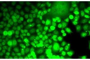 Immunofluorescence analysis of MCF7 cells using ALOX15B Polyclonal Antibody (ALOX15B anticorps)