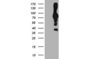 Western Blotting (WB) image for anti-phosphofructokinase, Platelet (PFKP) antibody (ABIN1500163) (PFKP anticorps)