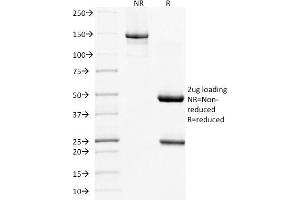 SDS-PAGE Analysis Purified MUC16 Mouse Monoclonal Antibody (MUC16/1860). (MUC16 anticorps)