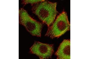 C2C12 cells were fixed with 4% PFA (20 min), permeabilized with Triton X-100 (0.