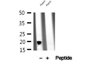 Western blot analysis of extracts of HepG2 cells, using NDUFB11 antibody. (NDUFB11 anticorps  (N-Term))