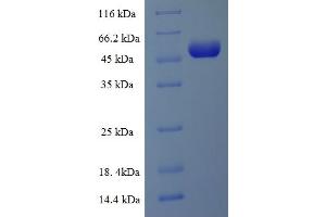 SDS-PAGE (SDS) image for Solute Carrier Family 27 (Fatty Acid Transporter), Member 2 (SLC27A2) (AA 283-620), (Cytoplasmic Domain), (Cytosolic) protein (His-SUMO Tag) (ABIN5710372)