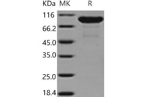 Western Blotting (WB) image for Matrix Metallopeptidase 9 (Gelatinase B, 92kDa Gelatinase, 92kDa Type IV Collagenase) (MMP9) (Active) protein (His tag) (ABIN7196958)