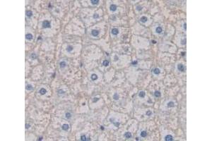 IHC-P analysis of Human Tissue, with DAB staining. (S100A12 anticorps  (AA 1-92))