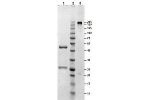 SDS-PAGE results of Sheep Gamma Globulin. (gamma Globulin Fraction Protéine)