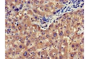 Immunohistochemistry of paraffin-embedded human liver tissue using ABIN7146747 at dilution of 1:100 (NOS1AP anticorps  (C-Term))