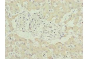 Immunohistochemistry of paraffin-embedded human liver tissue using ABIN7174236 at dilution of 1:100 (MNF1 anticorps  (AA 14-126))