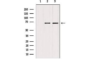 Western blot analysis of extracts from various samples, using ATP6V1A antibody. (ATP6V1A anticorps  (C-Term))