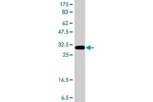 Western Blot detection against Immunogen (37.
