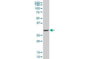 SIX3 monoclonal antibody (M04), clone 1A2. (SIX3 anticorps  (AA 273-332))