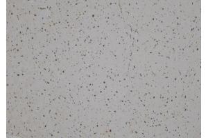 ABIN6275887 at 1/100 staining Human heart tissue by IHC-P. (LHX1 anticorps  (Internal Region))