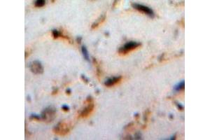 Used in DAB staining on fromalin fixed paraffin-embedded Heart tissue (Cardiotrophin 1 anticorps  (AA 1-201))