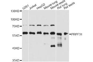 Western blot analysis of extracts of various cell lines, using PRPF31 antibody (ABIN2564749) at 1:3000 dilution. (PRPF31 anticorps)
