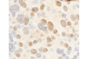 Immunohistochemistry (IHC) image for anti-V-Myb Myeloblastosis Viral Oncogene Homolog (Avian) (MYB) (AA 1-50) antibody (ABIN7453466)