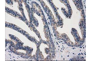 Image no. 7 for anti-ADP-Ribosylation Factor GTPase Activating Protein 1 (ARFGAP1) antibody (ABIN1496679) (ARFGAP1 anticorps)