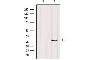Western blot analysis of extracts from COS-7, using TNNI3 Antibody. (TNNI3 anticorps)