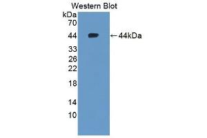 Detection of Recombinant NIS, Human using Polyclonal Antibody to Sodium Iodide Symporter (NIS)