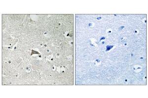 Immunohistochemistry analysis of paraffin-embedded human brain tissue, using VEGFR1 antibody. (FLT1 anticorps  (Tyr1048))