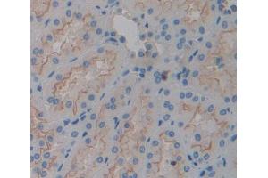 Used in DAB staining on fromalin fixed paraffin- embedded kidney tissue