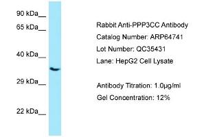Western Blotting (WB) image for anti-Protein Phosphatase 3, Catalytic Subunit, gamma Isozyme (PPP3CC) (C-Term) antibody (ABIN2789946) (PPP3CC anticorps  (C-Term))
