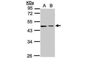 WB Image Sample(30 ug whole cell lysate) A:A431, B:Hep G2 , 10% SDS PAGE antibody diluted at 1:1000 (GALK2 anticorps)
