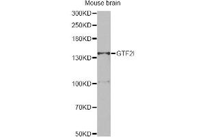 Western blot analysis of extracts of mouse brain, using GTF2I antibody (ABIN5995399) at 1/500 dilution. (GTF2I anticorps)
