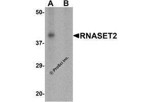 Western Blotting (WB) image for anti-Ribonuclease T2 (RNASET2) (C-Term) antibody (ABIN1030623) (RNASET2 anticorps  (C-Term))