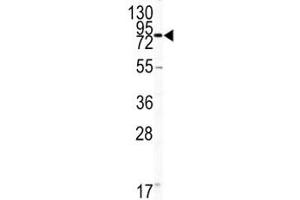 Western blot analysis of CD31 antibody and HL-60 lysate.