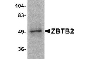 Western Blotting (WB) image for anti-Zinc Finger and BTB Domain Containing 2 (ZBTB2) (Middle Region) antibody (ABIN1031170) (ZBTB2 anticorps  (Middle Region))