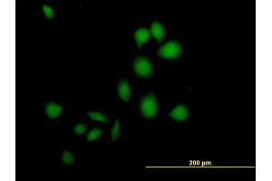 Immunofluorescence of purified MaxPab antibody to DSCR1 on HeLa cell.