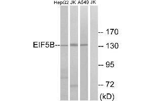 Western blot analysis of extracts from HepG2 cells, Jurkat cells and A549 cells, using EIF5B antibody. (EIF5B anticorps  (Internal Region))
