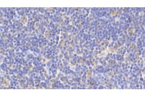 Detection of IL18 in Porcine Lymph node Tissue using Polyclonal Antibody to Interleukin 18 (IL18)
