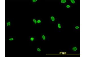 Image no. 3 for anti-RNA Binding Motif Protein, X-Linked-Like 2 (RBMXL2) (AA 1-91) antibody (ABIN599219) (RBMXL2 anticorps  (AA 1-91))