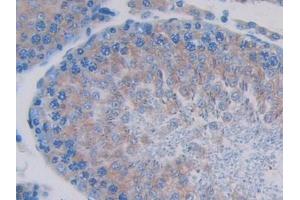 Detection of SIGIRR in Rat Testis Tissue using Polyclonal Antibody to Single Ig IL1 Related Receptor (SIGIRR)