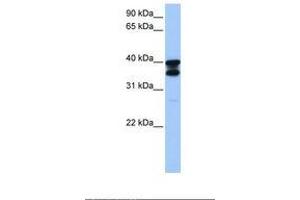 Image no. 1 for anti-Solute Carrier Family 25 (Mitochondrial Carrier, Adenine Nucleotide Translocator), Member 31 (SLC25A31) (AA 25-74) antibody (ABIN6738911) (SLC25A31 anticorps  (AA 25-74))