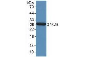 Detection of Recombinant TPT1, Human using Polyclonal Antibody to Tumor Protein, Translationally Controlled 1 (TPT1) (TPT1 anticorps  (AA 1-172))