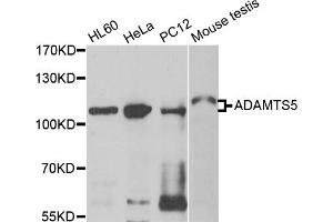 Western blot analysis of extracts of various cell lines, using ADAMTS5 antibody (ABIN5975868) at 1/500 dilution. (ADAMTS5 anticorps)