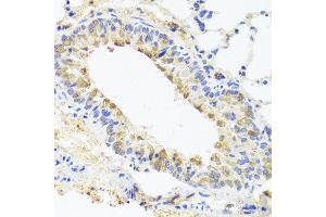 Immunohistochemistry of paraffin-embedded mouse lung using BGLAP antibody at dilution of 1:100 (x40 lens). (Osteocalcin anticorps)
