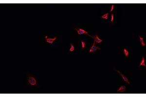 ABIN6269303 staining HeLa cells by IF/ICC. (FOXO4 anticorps  (C-Term))