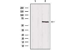 Western blot analysis of extracts from mouse brain, using CLIP3 Antibody. (CLIP3 anticorps  (Internal Region))