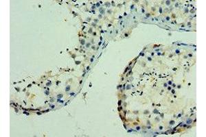 Immunohistochemistry of paraffin-embedded human testis tissue using ABIN7169136 at dilution of 1:100 (PAK6 anticorps  (AA 1-270))