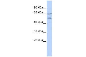 WB Suggested Anti-ZNF415 Antibody Titration:  0. (ZNF415 anticorps  (N-Term))