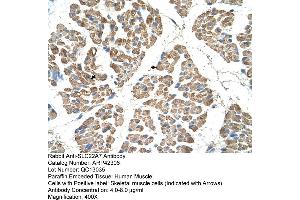 Rabbit Anti-SLC22A7 Antibody  Paraffin Embedded Tissue: Human Muscle Cellular Data: Skeletal muscle cells Antibody Concentration: 4.