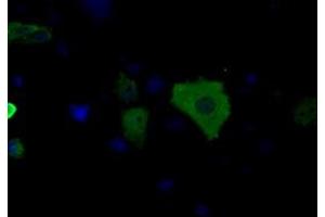 Image no. 4 for anti-3-hydroxybutyrate Dehydrogenase, Type 2 (BDH2) antibody (ABIN1496856)