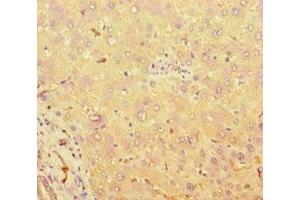 Immunohistochemistry of paraffin-embedded human liver tissue using ABIN7171544 at dilution of 1:100 (TAS2R38 anticorps  (AA 212-251))
